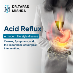 Acid Reflux: A Modern Life Style Disease – Causes, Symptoms & the Importance of Surgical Intervention