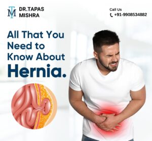 All That You Need to Know About Hernia