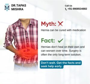 Is Surgery Always Required for Hernia?