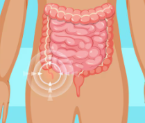 Appendix and acute abdomen