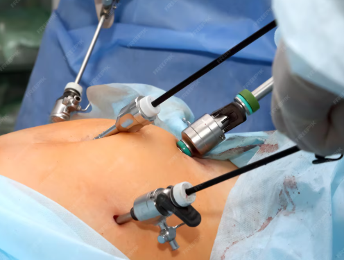 Single-port laparoscopic technique