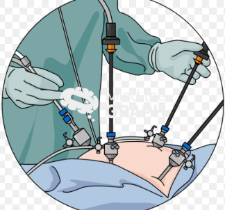 Diagnostic laparoscopy icon