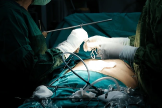 Bariatric and GI procedures