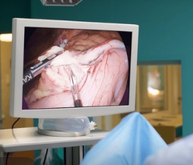Laparoscopic monitor view